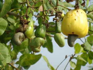 BỆNH THÁN THƯ TRÊN CÂU ĐIỀU